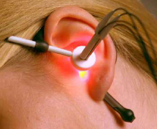 Kulak Çınlaması Lazer Tedavisi